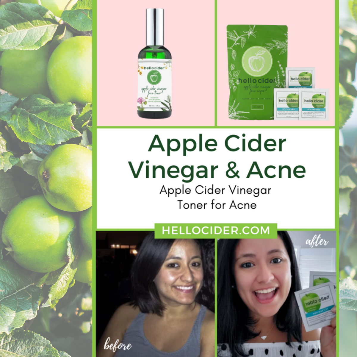 Acne organic facial tonerspray